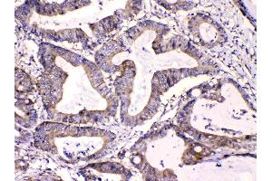 IHC analysis of Calpastatin using anti-Calpastatin antibody .