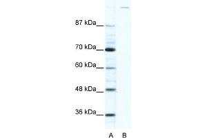 WB Suggested Anti-GLI1 Antibody Titration:  2. (GLI1 anticorps  (C-Term))