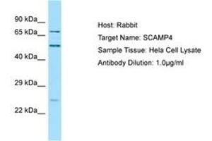 Image no. 1 for anti-Secretory Carrier Membrane Protein 4 (SCAMP4) (C-Term) antibody (ABIN6750133)
