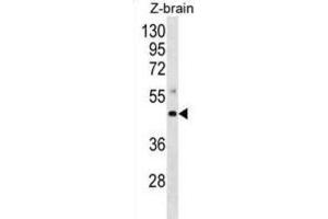 Western Blotting (WB) image for anti-Mitogen-Activated Protein Kinase Kinase 4 (MAP2K4) antibody (ABIN2998350)