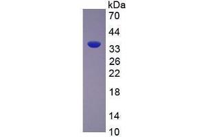 Image no. 1 for Arginase (ARG) (AA 1-323) (Active) protein (His tag) (ABIN6239897) (ARG Protein (AA 1-323) (His tag))