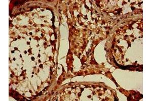 Immunohistochemistry of paraffin-embedded human testis tissue using ABIN7169222 at dilution of 1:100 (WNK1 anticorps  (AA 1-207))