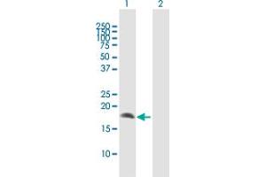 Western Blot analysis of CRYGD expression in transfected 293T cell line by CRYGD MaxPab polyclonal antibody. (CRYGD anticorps  (AA 1-174))