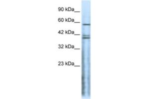 Western Blotting (WB) image for anti-Cholinergic Receptor, Nicotinic, delta (Muscle) (CHRND) antibody (ABIN2463735) (CHRND anticorps)