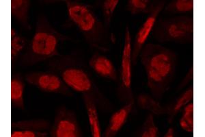 Anti-ATM Monoclonal Antibody - Immunofluorescence Microscopy  anti-ATM pS1981 mouse monoclonal antibody (Catalog # 200-301-400) detects ATM phosphorylated on Ser 1981 by Indirect immunofluorescence microscopy.