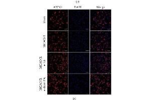 ABIN1 expression in the peri-infarct area at different time points.