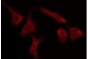 ABIN6276082 staining HeLa by IF/ICC. (OR51E1 anticorps  (C-Term))