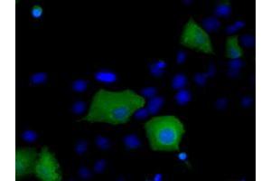 Image no. 4 for anti-Sorting Nexin 9 (SNX9) antibody (ABIN1501046)