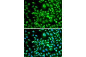 Immunohistochemistry of paraffin-embedded human stomach using SETD5 antibody at dilution of 1:100 (x400 lens). (SETD5 anticorps)