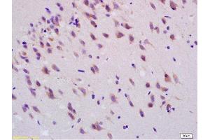 Formalin-fixed and paraffin embedded rat brain labeled with Anti-Smoothened/SMO Polyclonal Antibody, Unconjugated  at 1:200, followed by conjugation to the secondary antibody and DAB staining (SMO anticorps  (AA 551-650))