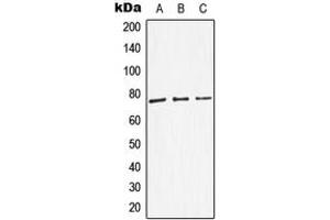 Western blot analysis of Dopamine beta Hydroxylase expression in HEK293T (A), SP2/0 (B), NIH3T3 (C) whole cell lysates. (DBH anticorps  (Center))