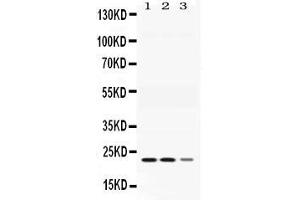 Western blot analysis of Adenylate Kinase 1 expression in rat skeletal muscle extract ( Lane 1), mouse cardiac muscle  extract ( Lane 2) and COLO320 whole cell lysates ( Lane 3). (Adenylate Kinase 1 anticorps  (C-Term))