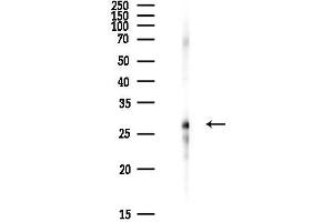 Western blot analysis of lysates from Hela cells(heat-shock,45 min treatment), using ZMYN Antibody at 1/1000 dilution.