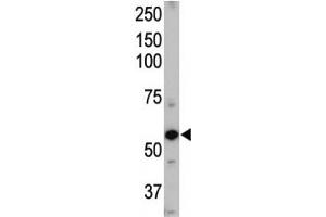 Western blot of ALK1 antibody and mouse heart tissue lysate.