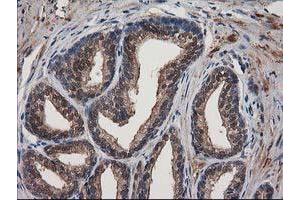 Image no. 13 for anti-Destrin (Actin Depolymerizing Factor) (DSTN) antibody (ABIN1497908)