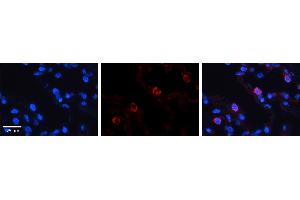 VARS antibody - middle region          Formalin Fixed Paraffin Embedded Tissue:  Human Lung Tissue    Observed Staining:  Cytoplasm of pneumocytes   Primary Antibody Concentration:  1:100    Other Working Concentrations:  1/600    Secondary Antibody:  Donkey anti-Rabbit-Cy3    Secondary Antibody Concentration:  1:200    Magnification:  20X    Exposure Time:  0.
