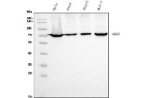 Western blot analysis of Ku70 using anti-Ku70 antibody (ABIN7602791).