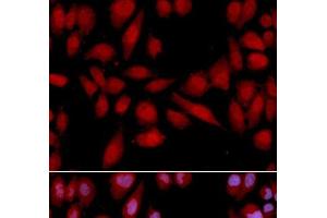 Immunofluorescence analysis of U2OS cells using PSMA2 Polyclonal Antibody (PSMA2 anticorps)