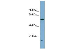 ALDH3A2 antibody used at 1 ug/ml to detect target protein. (ALDH3A2 anticorps  (Middle Region))