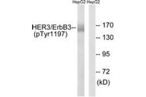 Western blot analysis of extracts from HepG2 cells , using HER3 (Phospho-Tyr1197) Antibody. (ERBB3 anticorps  (pTyr1197))