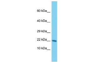 Host: Rabbit Target Name: NUDT3 Sample Type: Hela Whole Cell lysates Antibody Dilution: 1. (NUDT3 anticorps  (Middle Region))