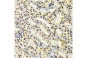 Immunohistochemistry (IHC) image for anti-Deoxycytidine Kinase (DCK) (AA 1-260) antibody (ABIN3022558)