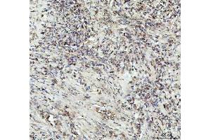 IHC analysis of G-CSF/CSF3 using anti-G-CSF/CSF3 antibody (ABIN3042762). (G-CSF anticorps  (AA 38-207))