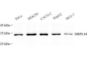 Western blot analysis of MRPL44 (ABIN7074647) at dilution of 1: 500 (MRPL44 anticorps)
