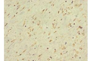 Immunohistochemistry of paraffin-embedded human smooth muscle tissue using ABIN7158484 at dilution of 1:100 (LONRF1 anticorps  (AA 538-773))