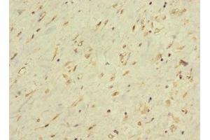 Immunohistochemistry of paraffin-embedded human smooth muscle tissue using ABIN7158484 at dilution of 1:100 (LONRF1 anticorps  (N-Term))