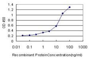 Detection limit for recombinant GST tagged AKR1C2 is approximately 0.