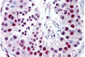 Testis (MECP2 anticorps  (AA 11-25))
