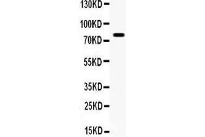 Anti- FE65 antibody, Western blotting All lanes: Anti  at 0. (FE65 anticorps  (AA 295-613))