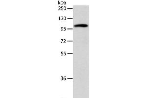 Western Blot analysis of 293T cell using ADCY1 Polyclonal Antibody at dilution of 1:1000 (ADCY1 anticorps)