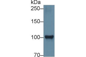 Detection of HK1 in Rat Cerebrum lysate using Polyclonal Antibody to Hexokinase 1 (HK1) (Hexokinase 1 anticorps  (AA 413-540))