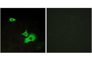 Immunofluorescence analysis of LOVO cells, using ETBR2 Antibody. (ETBR2 anticorps  (AA 1-50))