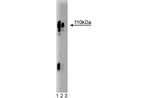 Western blot analysis of Lamp-1 on HepG2 cell lysate. (LAMP1 anticorps  (AA 25-224))