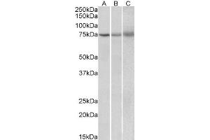 ABIN2563581 (2µg/ml) staining of Human (A), Mouse (B) and Rat (C) Spleen lysate (35µg protein in RIPA buffer). (KLHL6 anticorps  (Internal Region))