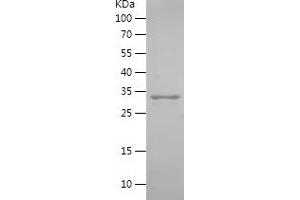 Western Blotting (WB) image for Uroplakin 2 (UPK2) (AA 85-184) protein (His-IF2DI Tag) (ABIN7125666)