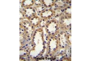 GPC6 Antibody (C-term) immunohistochemistry analysis in formalin fixed and paraffin embedded human kidney tissue followed by peroxidase conjugation of the secondary antibody and DAB staining. (Glypican 6 anticorps  (C-Term))