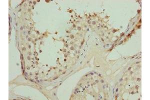 Immunohistochemistry of paraffin-embedded human testis tissue using ABIN7162475 at dilution of 1:100 (TRIP13 anticorps  (AA 181-390))
