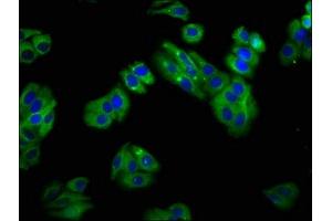 Immunofluorescence staining of HepG2 cells with ABIN7170156 at 1:100, counter-stained with DAPI. (SLC22A25 anticorps  (AA 31-145))