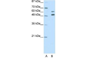Western Blot showing ZNF682 antibody used at a concentration of 1-2 ug/ml to detect its target protein. (ZNF682 anticorps  (N-Term))