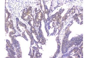 IHC analysis of PPID using anti-PPID antibody (ABIN6719438). (PPID anticorps  (AA 306-370))