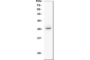 Western blot analysis of CD160 using anti-CD160 antibody (ABIN6719459).