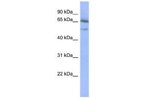 WB Suggested Anti-NFKBIE Antibody Titration:  0. (NFKBIE anticorps  (Middle Region))