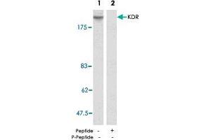 Western blot analysis of extract from SK-OV-3 cells using KDR polyclonal antibody  . (VEGFR2/CD309 anticorps)