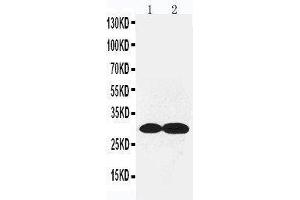 Anti-Collagen IV antibody, Western blotting Lane 1: Rat Kidney Tissue Lysate Lane 2: Rat Lung Tissue Lysate (COL4a2 anticorps  (C-Term))