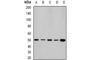 Western blot analysis of NFS1 expression in HepG2 (A), SKOV3 (B), mouse kidney (C), mouse heart (D), rat liver (E) whole cell lysates. (NFS1 anticorps)