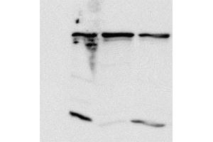 Hela lysates were incubated with Anti-MAD1L1 (clone 9B10) and the immunecomplex precipitated with protein G coupled beads. (PSMD14 anticorps)